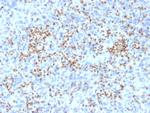 PU.1 (SPI-1) Antibody in Immunohistochemistry (Paraffin) (IHC (P))