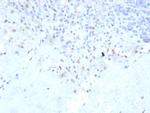 PU.1 (SPI-1) (B-Cell Marker) Antibody in Immunohistochemistry (Paraffin) (IHC (P))