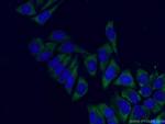 RPS6 Antibody in Immunocytochemistry (ICC/IF)