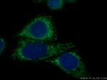 mTOR Antibody in Immunocytochemistry (ICC/IF)