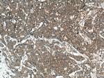 mTOR Antibody in Immunohistochemistry (Paraffin) (IHC (P))