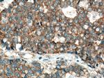 mTOR Antibody in Immunohistochemistry (Paraffin) (IHC (P))