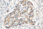 GLUT2 Antibody in Immunohistochemistry (Paraffin) (IHC (P))