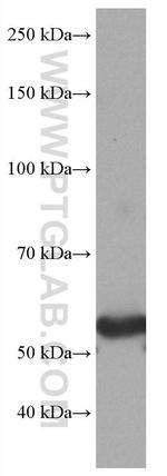 GLUT2 Antibody in Western Blot (WB)