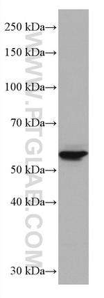 GLUT2 Antibody in Western Blot (WB)