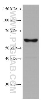 TERF2 Antibody in Western Blot (WB)