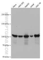 Alpha Actinin Antibody in Western Blot (WB)