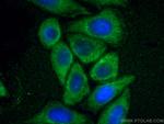 UPF1 Antibody in Immunocytochemistry (ICC/IF)