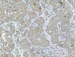 UPF1 Antibody in Immunohistochemistry (Paraffin) (IHC (P))