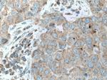 UPF1 Antibody in Immunohistochemistry (Paraffin) (IHC (P))