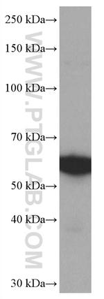 SPTLC1 Antibody in Western Blot (WB)