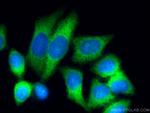 YAP1 Antibody in Immunocytochemistry (ICC/IF)