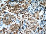 YAP1 Antibody in Immunohistochemistry (Paraffin) (IHC (P))