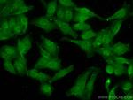 Glucocorticoid receptor Antibody in Immunocytochemistry (ICC/IF)