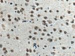 Glucocorticoid receptor Antibody in Immunohistochemistry (Paraffin) (IHC (P))