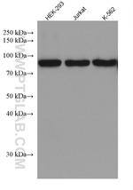 Glucocorticoid receptor Antibody in Western Blot (WB)