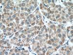 MAVS/VISA Antibody in Immunohistochemistry (Paraffin) (IHC (P))