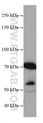 MAVS/VISA Antibody in Western Blot (WB)