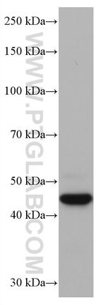 Cathepsin L Antibody in Western Blot (WB)