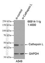 Cathepsin L Antibody in Western Blot (WB)