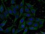 NFATC2 Antibody in Immunocytochemistry (ICC/IF)