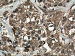 NFATC2 Antibody in Immunohistochemistry (Paraffin) (IHC (P))