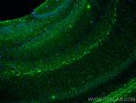 PTGER4 Antibody in Immunohistochemistry (Paraffin) (IHC (P))