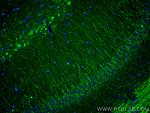 PTGER4 Antibody in Immunohistochemistry (Paraffin) (IHC (P))