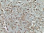 ROR1 Antibody in Immunohistochemistry (Paraffin) (IHC (P))