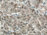 ADK Antibody in Immunohistochemistry (Paraffin) (IHC (P))