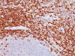 CD43 (T-Cell Marker) Antibody in Immunohistochemistry (Paraffin) (IHC (P))