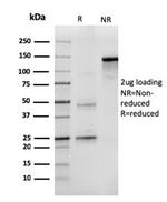 CD43 (T-Cell Marker) Antibody in SDS-PAGE (SDS-PAGE)