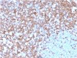 CD43 (T-Cell Marker) Antibody in Immunohistochemistry (Paraffin) (IHC (P))