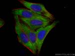 PPARG Antibody in Immunocytochemistry (ICC/IF)