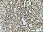 PPARG Antibody in Immunohistochemistry (Paraffin) (IHC (P))