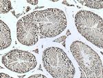 UBR5 Antibody in Immunohistochemistry (Paraffin) (IHC (P))