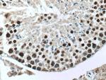 UBR5 Antibody in Immunohistochemistry (Paraffin) (IHC (P))