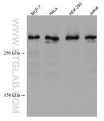 UBR5 Antibody in Western Blot (WB)