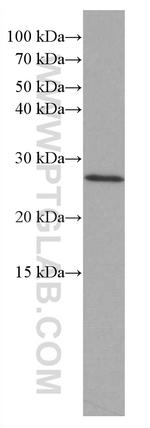 RAB27B Antibody in Western Blot (WB)