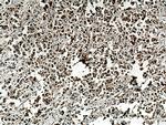 CDK4 Antibody in Immunohistochemistry (Paraffin) (IHC (P))