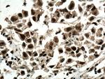 CDK4 Antibody in Immunohistochemistry (Paraffin) (IHC (P))