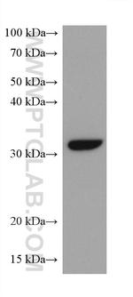 CDK4 Antibody in Western Blot (WB)