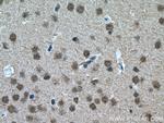 DBR1 Antibody in Immunohistochemistry (Paraffin) (IHC (P))