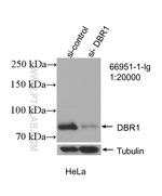DBR1 Antibody in Western Blot (WB)
