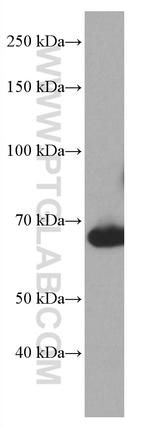 BLNK Antibody in Western Blot (WB)