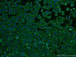 FGFR3 Antibody in Immunocytochemistry (ICC/IF)