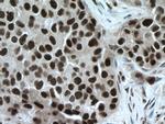 TBL1X Antibody in Immunohistochemistry (Paraffin) (IHC (P))