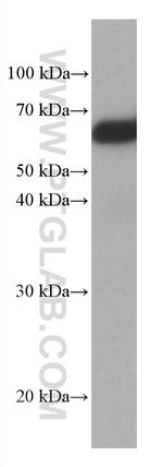 TBL1X Antibody in Western Blot (WB)