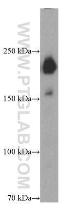 PAPPA Antibody in Western Blot (WB)