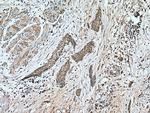 NFATC1 Antibody in Immunohistochemistry (Paraffin) (IHC (P))